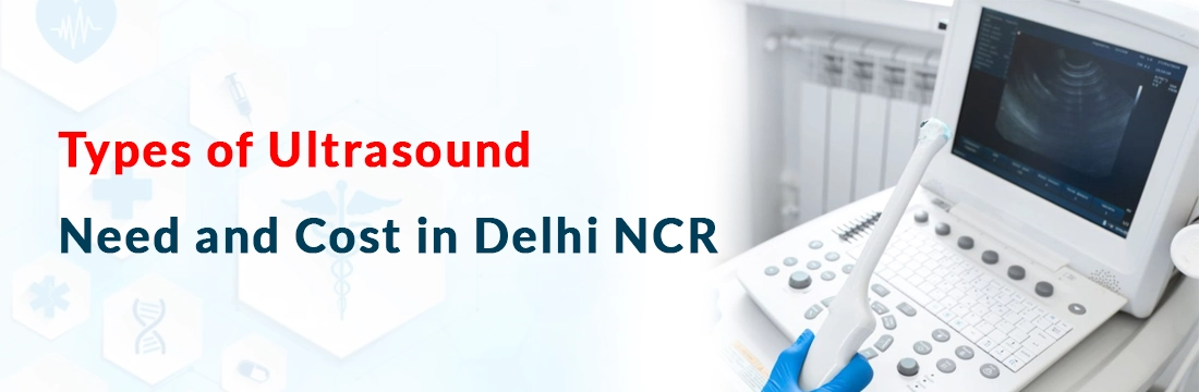 Types of Ultrasound: Need and Cost in Delhi NCR